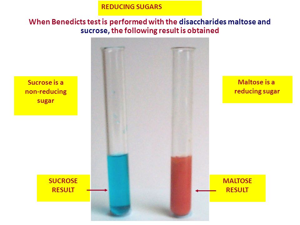 Reducing and non-reducing sugars tests.